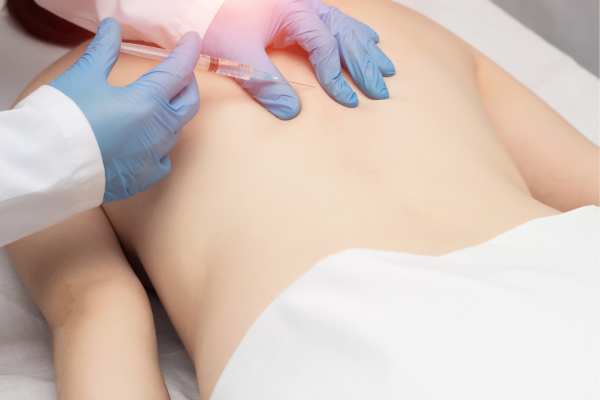 Lipo Sculpt will offer the best fat back reduction Virginia Water call us today!